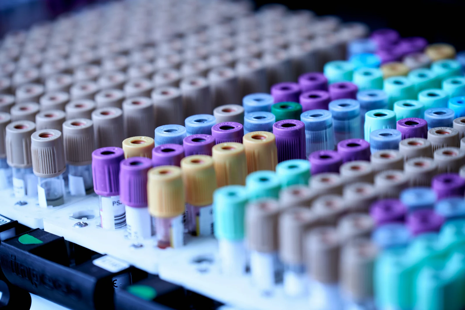 Rows of sample tubes waiting for analysis